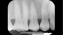 jaipicom_teeth-xray.png