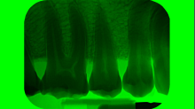 jaipicom_teeth-xray.png InvertBGRGreen