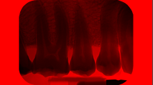 jaipicom_teeth-xray.png InvertBGRRed