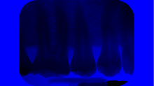 jaipicom_teeth-xray.png InvertGBRBlue