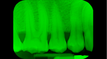 jaipicom_teeth-xray.png SwapBRGGreen