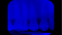 jaipicom_teeth-xray.png SwapGRBBlue