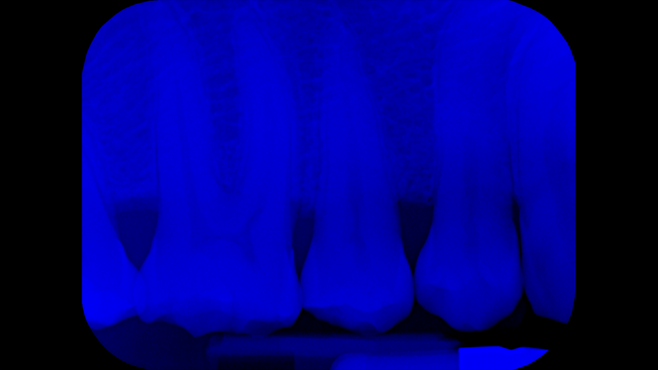 teeth-xray.png