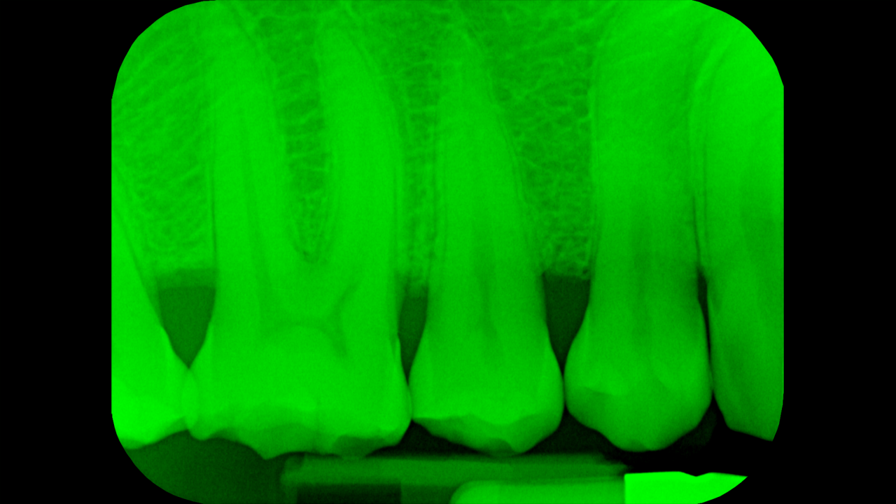 teeth-xray.png